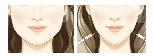 如何讓咬肌變??？