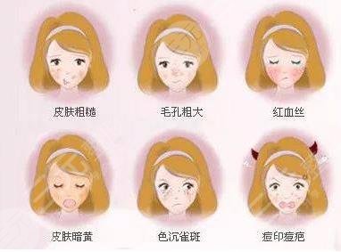 光子嫩膚適合哪些人群進(jìn)行操作?