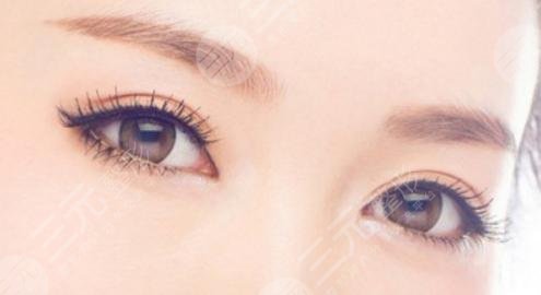 眼瞼皮膚松弛矯正術(shù)手術(shù)風(fēng)險(xiǎn)大嗎