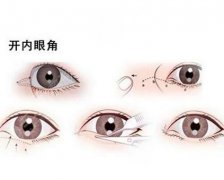 不適合開眼角眼型有哪些？一覽圖，look你到底是否適合開眼角...