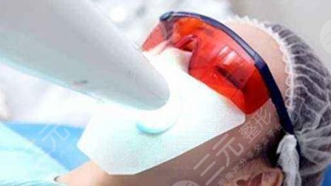 冷光美白牙齒的副作用大嗎