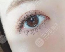 韓式or歐式雙眼皮合適更好，本文幫你分析到底適合什么風(fēng)格的~