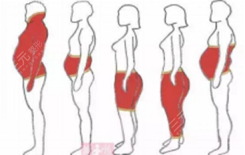 中醫(yī)減肥果