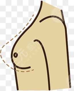 乳房懸吊圖片前后對比圖，術(shù)后一個(gè)月果反饋~