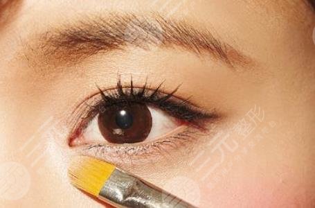 開眼角的注意事項(xiàng)