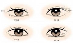 做雙眼皮手術(shù)疼嗎？手術(shù)的注意事項(xiàng)有哪些？你需要注意這些...