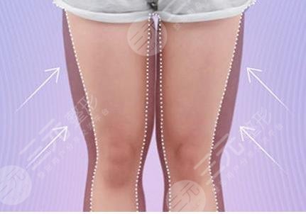 怎樣才可以瘦腿比較快？教你幾個(gè)小技巧，輕松瘦腿不是夢(mèng)！