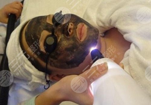 做黑臉娃娃有副作用嗎？黑臉娃娃的注意事項(xiàng)有哪些？