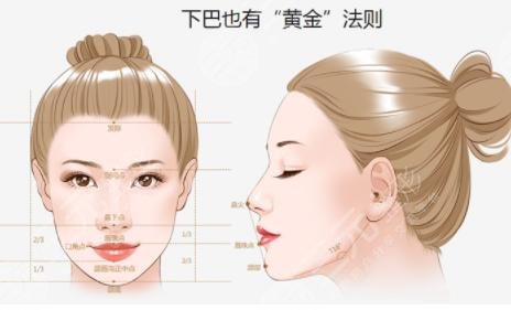 墊下巴的價位大概是多少錢