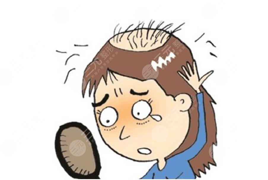 如何改良頭發(fā)脫落的問題