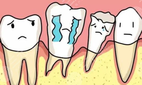 牙齒松動怎么治好的辦法