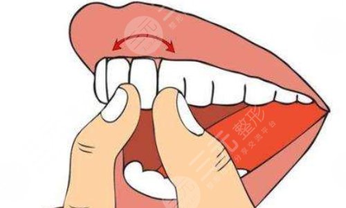 牙齒松動怎么治好的辦法