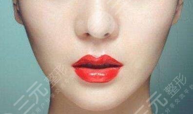 墊下巴的價位大概是多少錢？內附真人墊下巴的果參考~