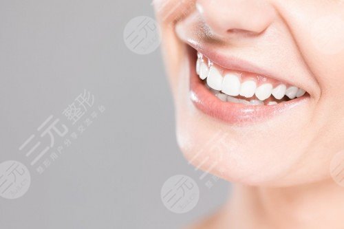 明星牙齒怎么那么白