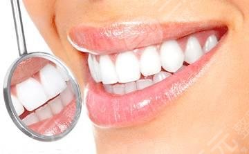 明星牙齒怎么那么白