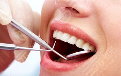 3m納米樹脂補牙好不好？來看看專業(yè)牙醫(yī)是怎么說的~