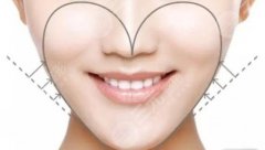 墊下巴價(jià)格大概多少？墊下巴手術(shù)的果案例展示，V臉太好看啦！