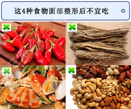 硅膠隆鼻假體取出術(shù)后注意事項