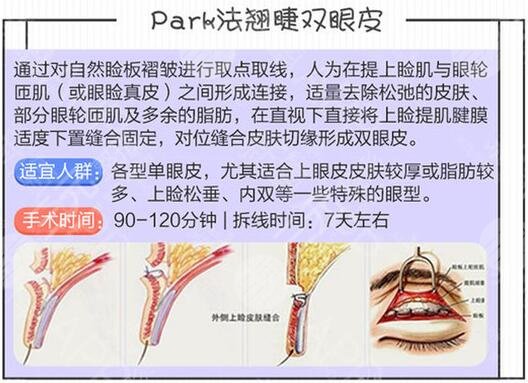 翹睫術雙眼皮成好嗎