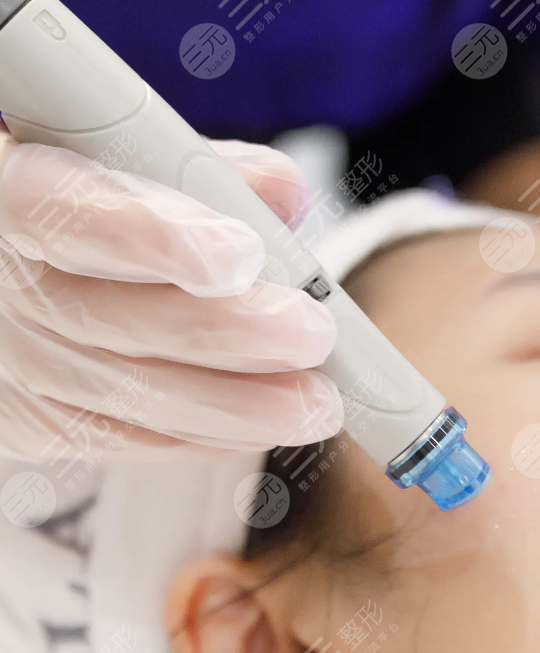 海菲秀多久做一次合適