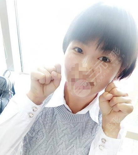 九院激光pm激光祛斑價格