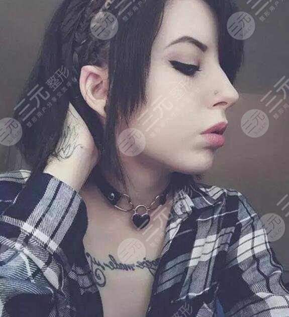 顱耳角在30°-60°之間整形