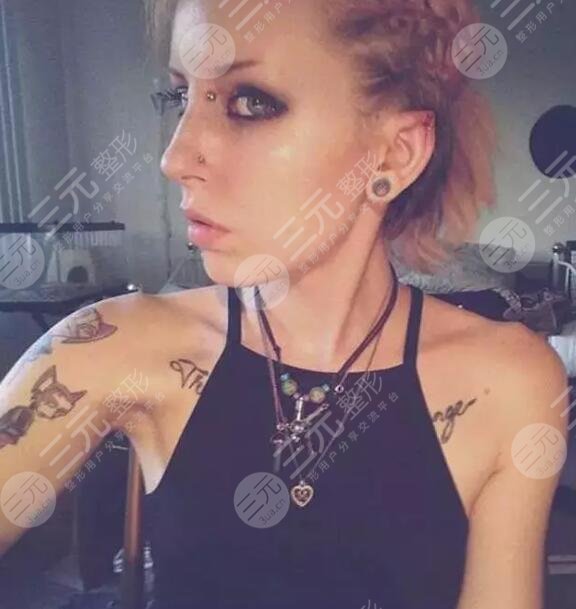 網(wǎng)紅顱耳角在30°-60°之間