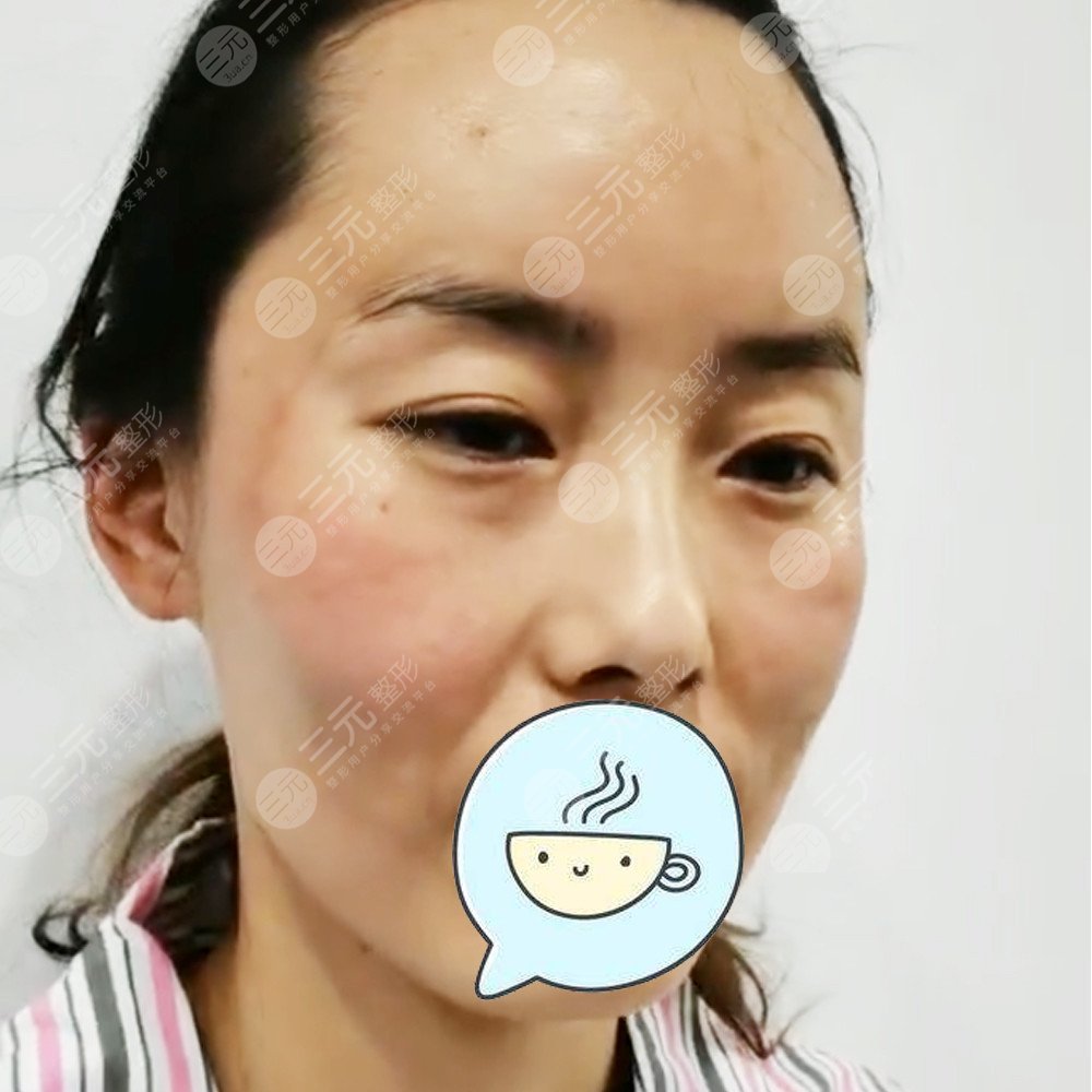 武漢美基元做熱瑪吉怎么樣