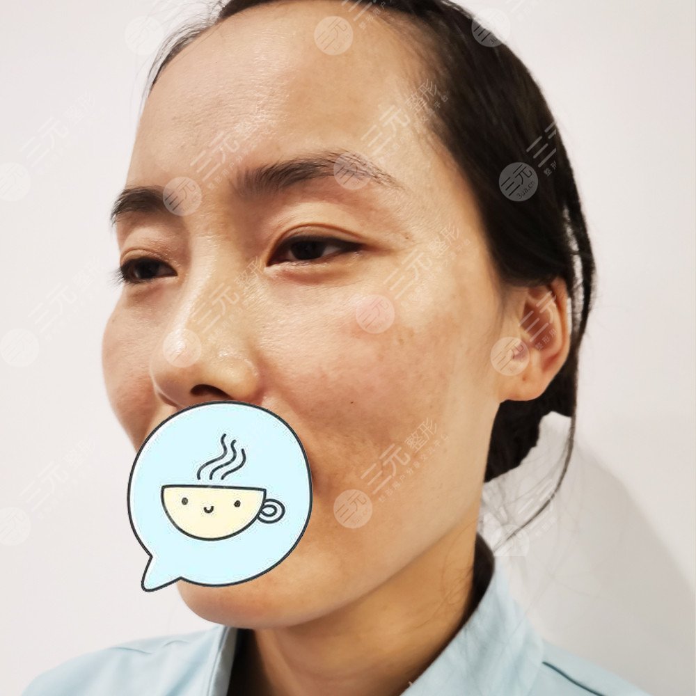 武漢美基元做熱瑪吉怎么樣