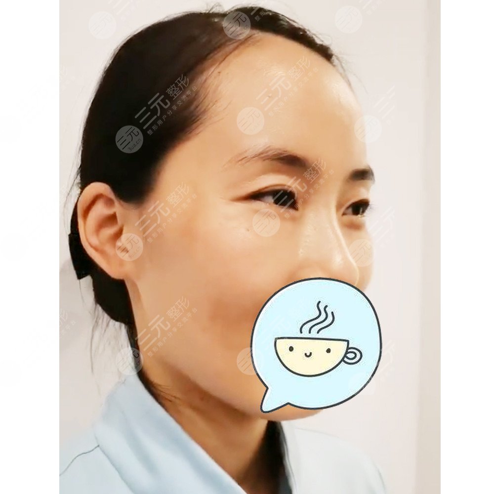 武漢美基元做熱瑪吉怎么樣