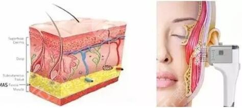 熱提拉和熱瑪吉的果上的區(qū)別