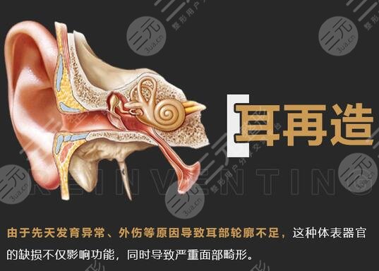 耳再造多少費(fèi)用？?jī)r(jià)格參考&手術(shù)科普，耳整形避雷指南！