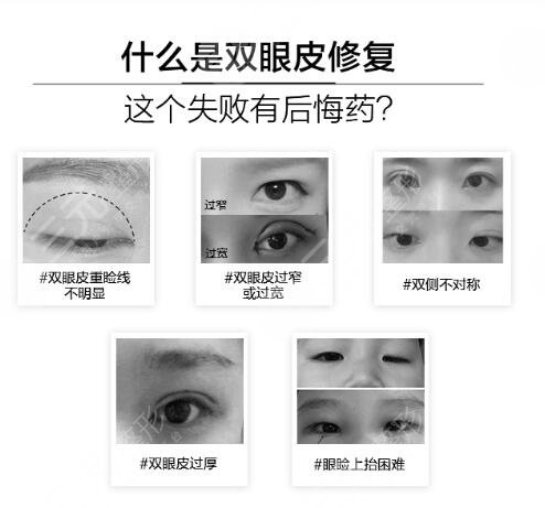 眼部修復(fù)相關(guān)知識(shí)