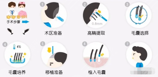 頭發(fā)種植術(shù)靠譜嗎