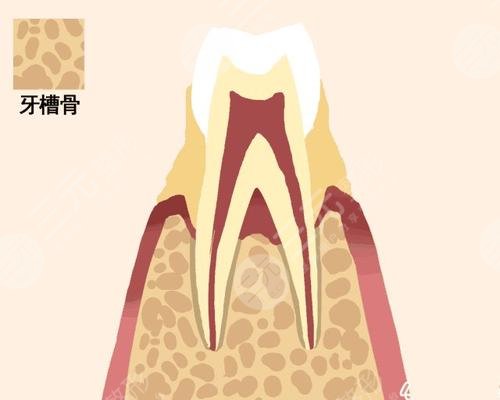 牙齒松動是什么原因?