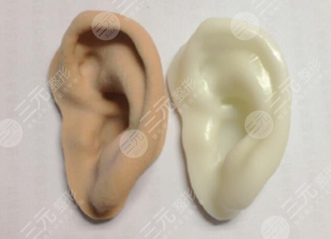 耳再造直埋手術(shù)的原理
