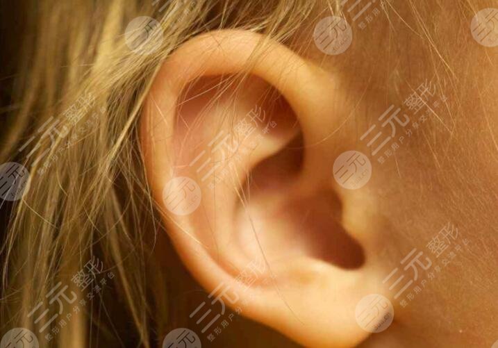 耳缺失再造手術(shù)技術(shù)成熟嗎？做手術(shù)有哪些注意事項？快來學(xué)習(xí)！