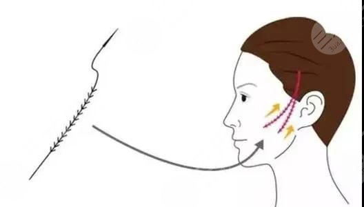 提升抗皺的副作用和危害