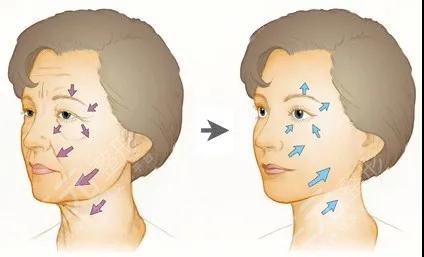 提升抗皺的副作用和危害