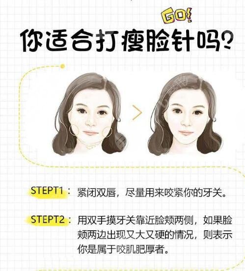 哪些人適合做注射瘦臉