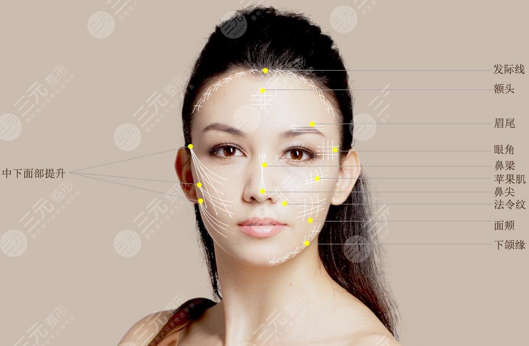 提升抗皺后多久可以做熱瑪吉