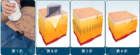 超塑溶脂的原理