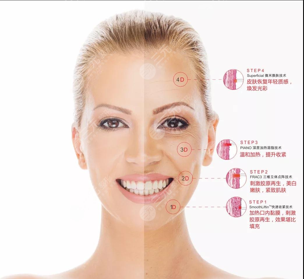 歐洲之星4d和熱瑪吉區(qū)別