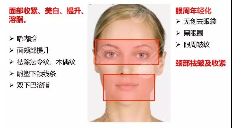 歐洲之星4d和熱瑪吉區(qū)別