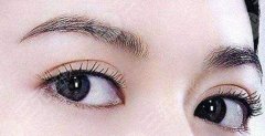 雙眼皮修復(fù)可以做眼部手術(shù)嗎？超全科普分享注意事項(xiàng)&果圖！