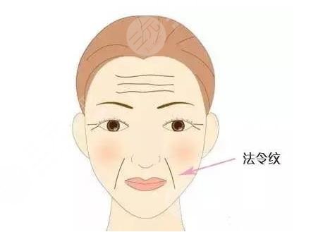 有法令紋怎么辦？去法令紋價格大概多少錢？附價格表