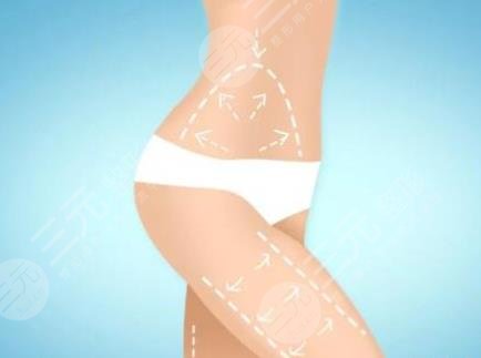 吸脂瘦腿相關(guān)科普介紹