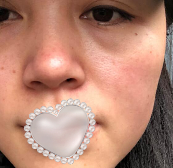 賽諾秀5D膠原光體驗日記