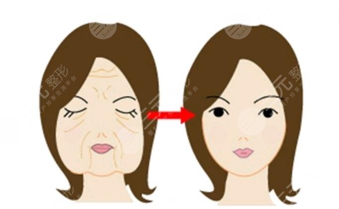 上海九院熱瑪吉相關(guān)科普