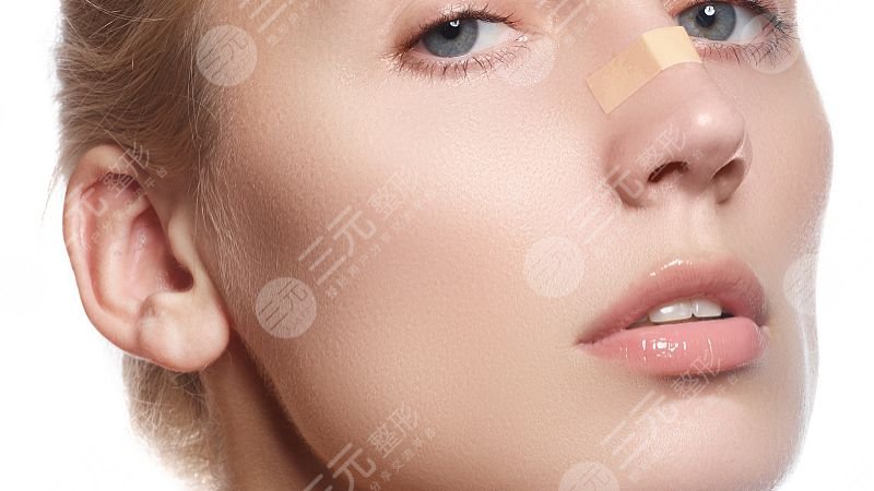 葡聚糖生物肋骨鼻降低風(fēng)險(xiǎn)嗎？多少錢？想要隆鼻的姐妹看過來！